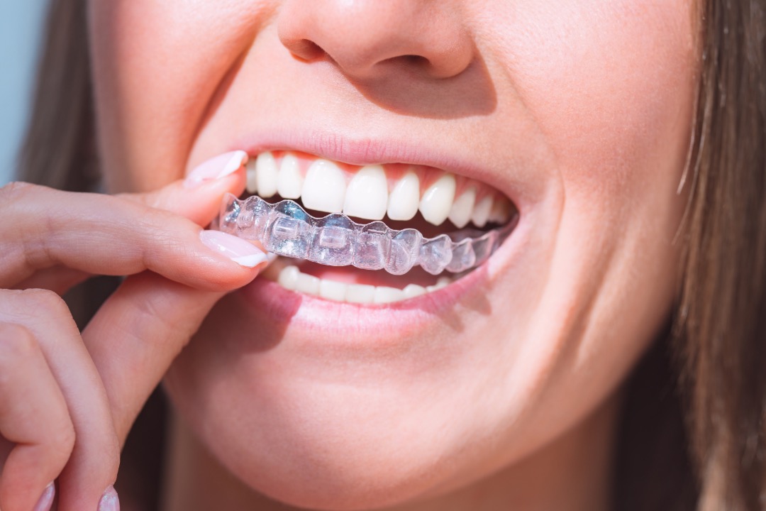 Ortodoncia Invisalign Bogotá